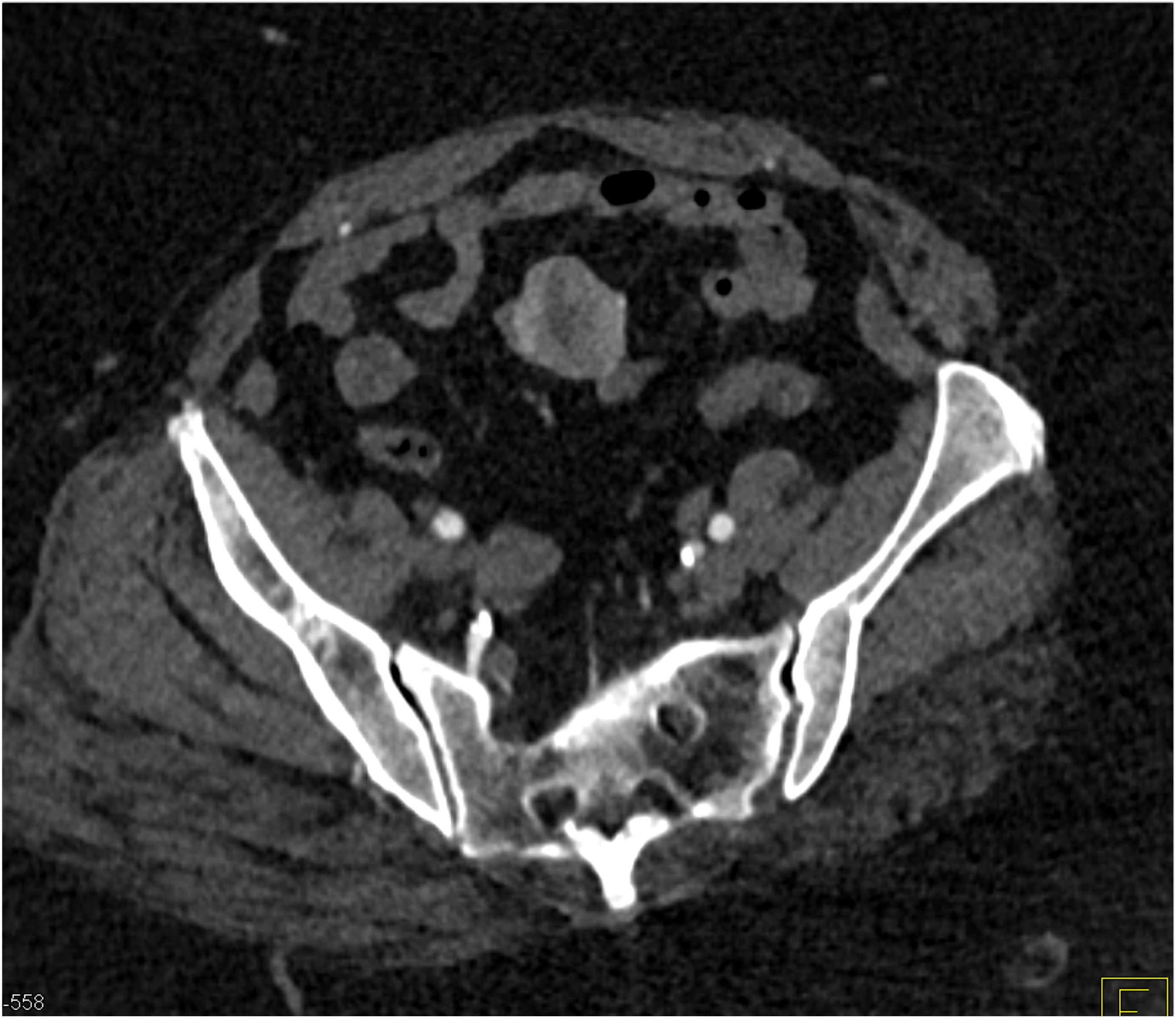 CTisus Quiz