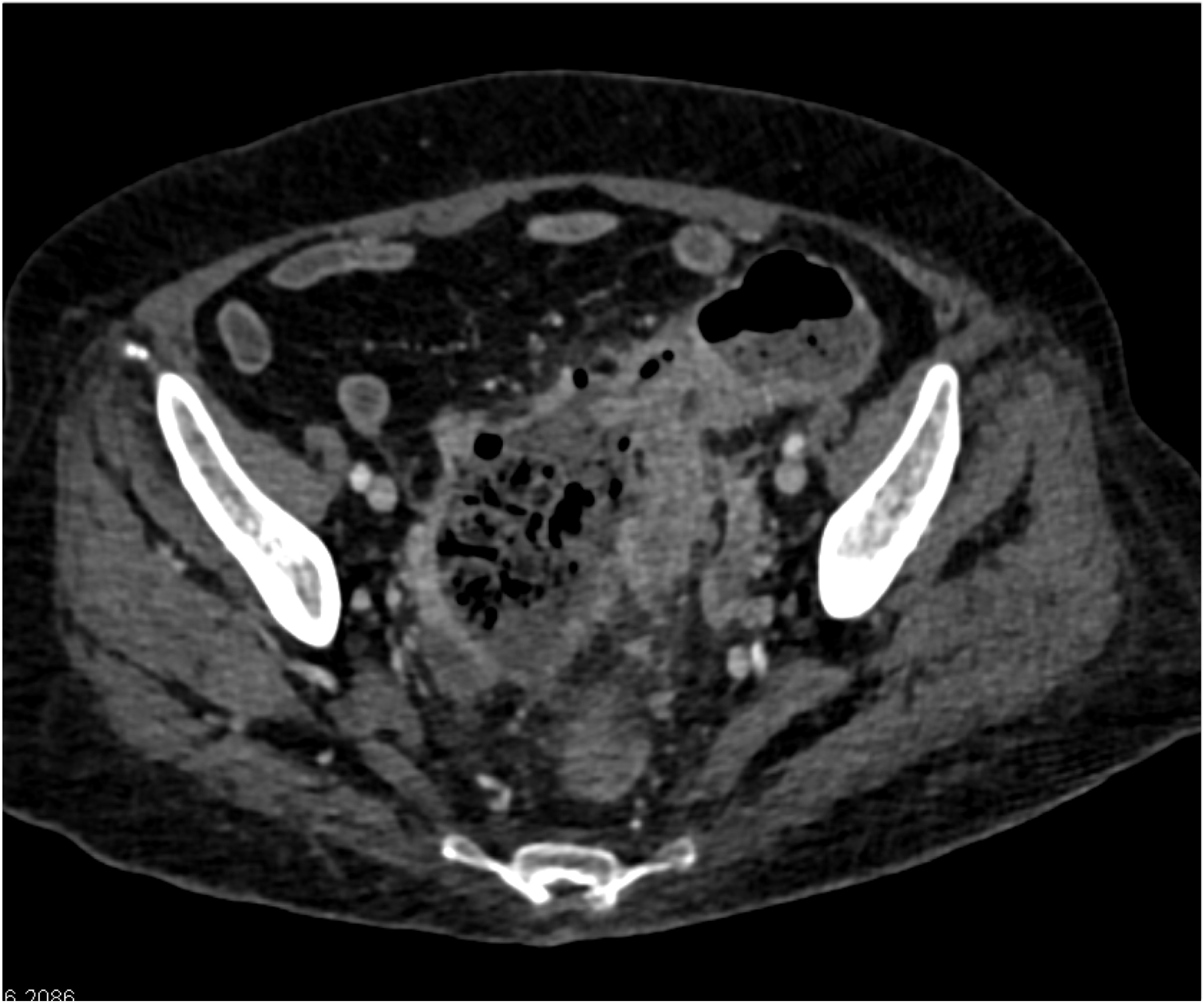 CTisus Quiz