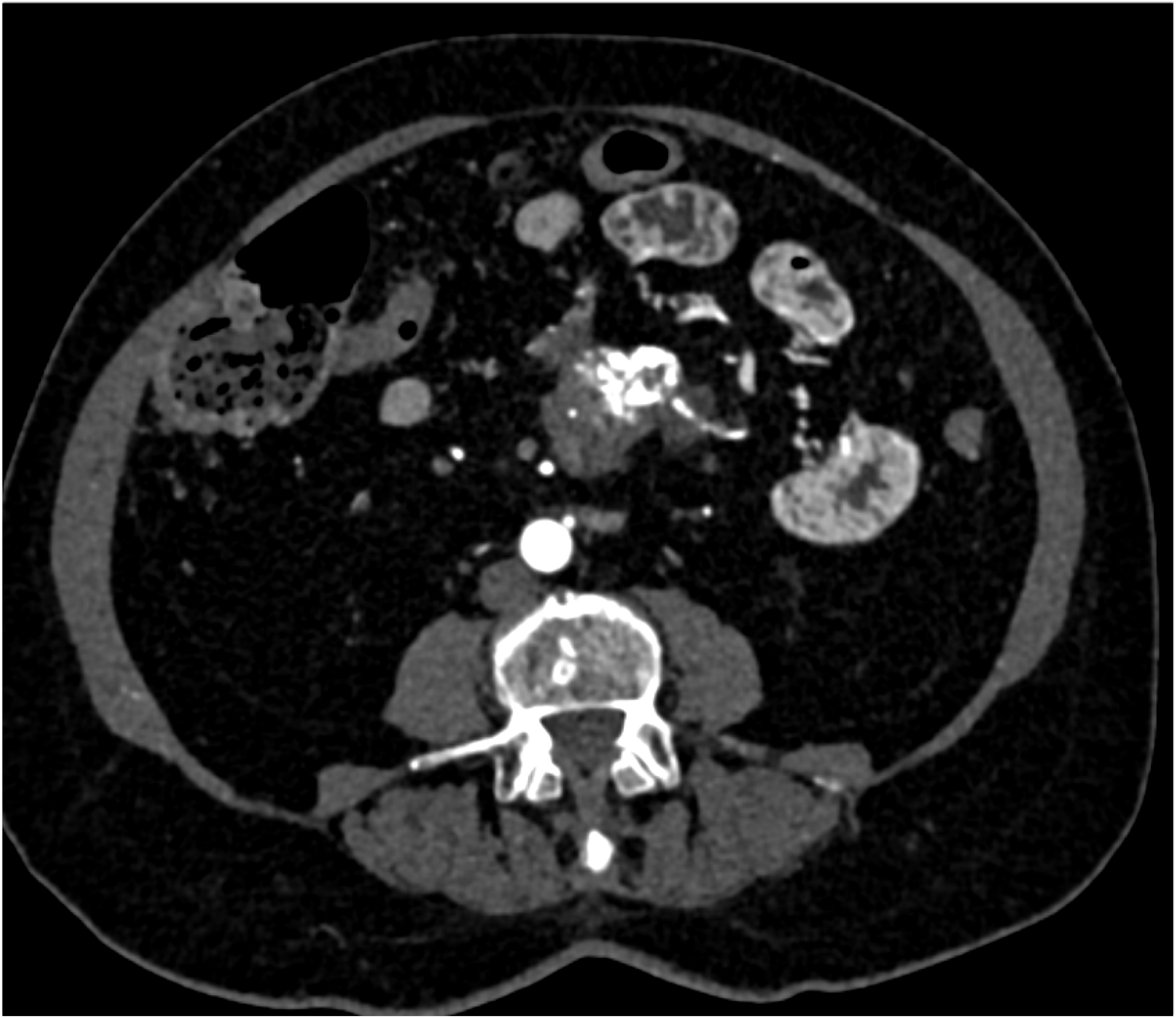 CTisus Quiz