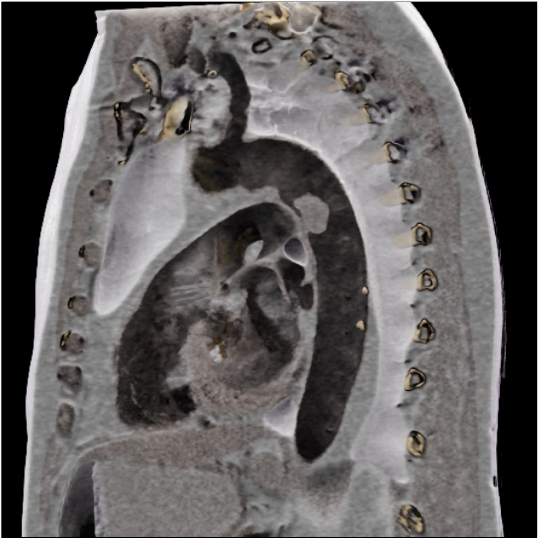 CTisus Quiz