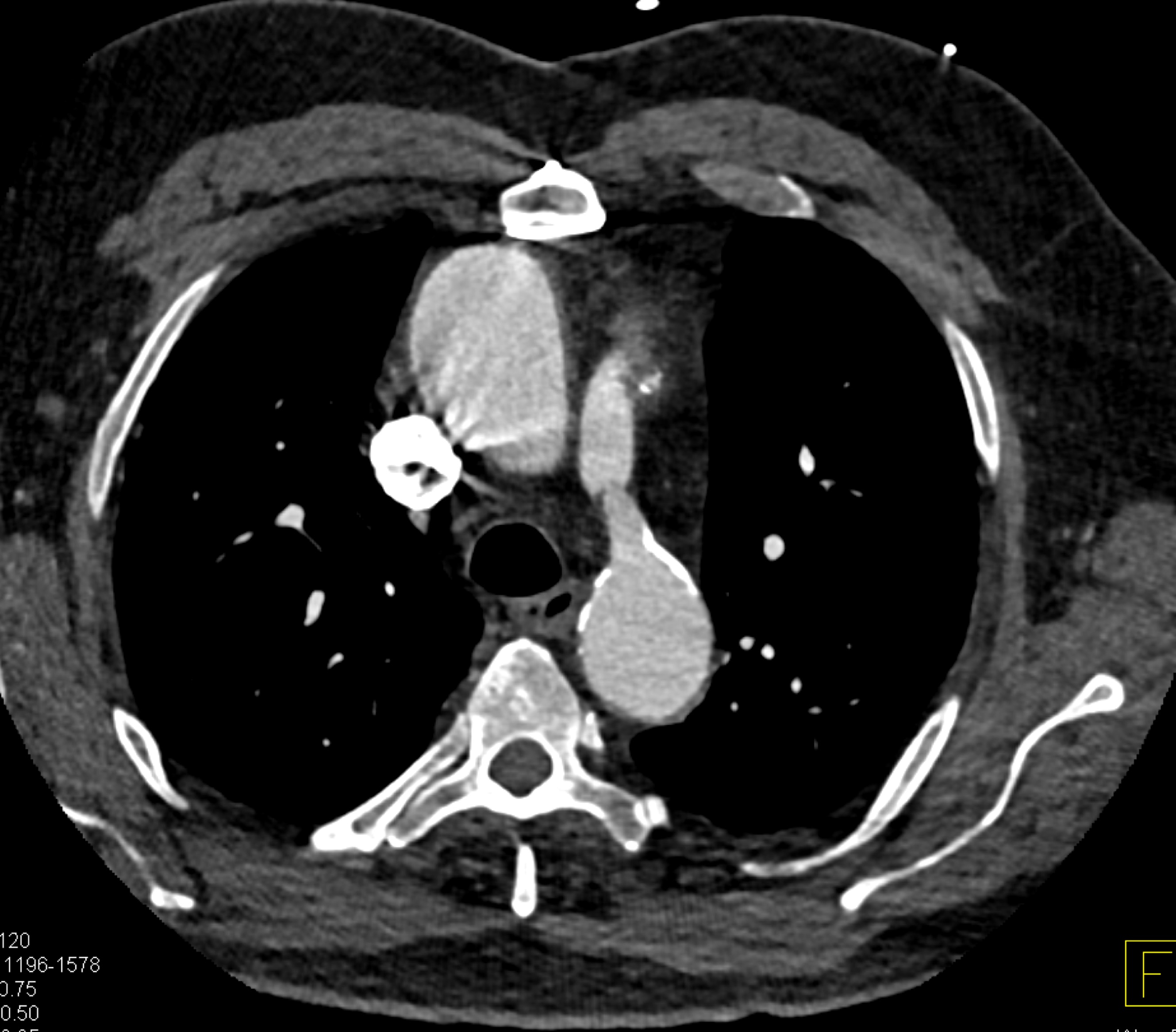 CTisus Quiz