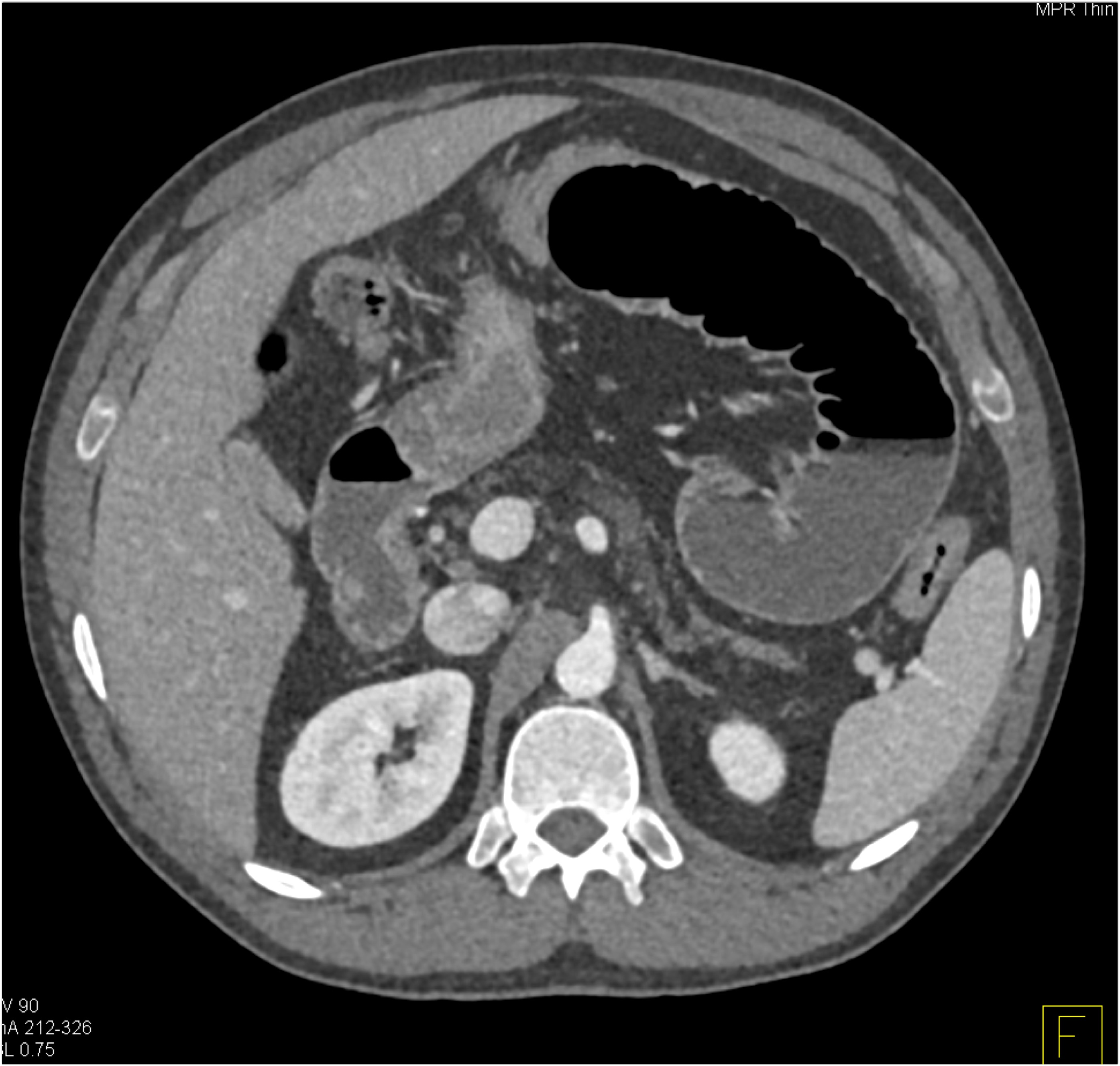 CTisus Quiz