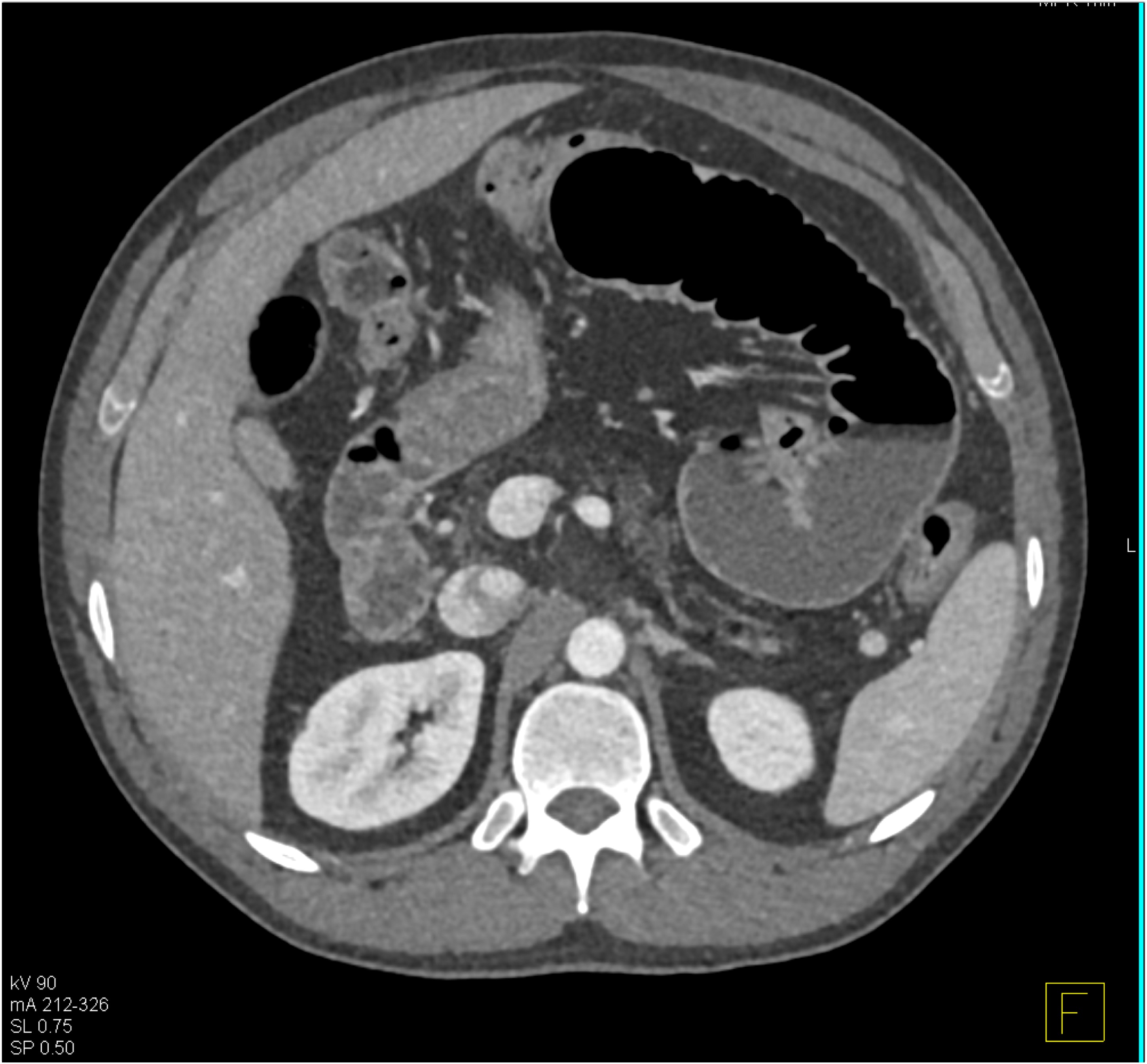 CTisus Quiz