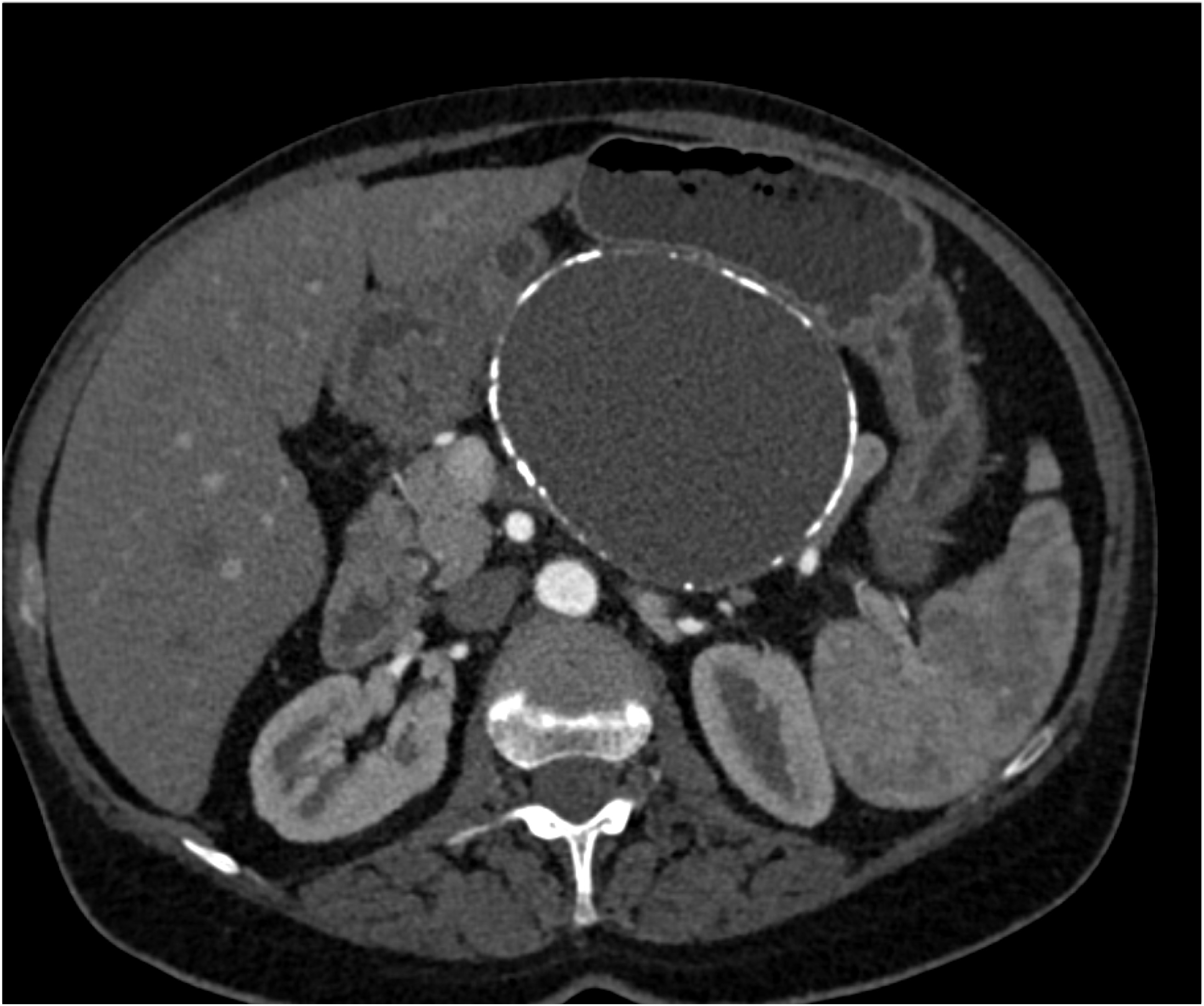 CTisus Quiz