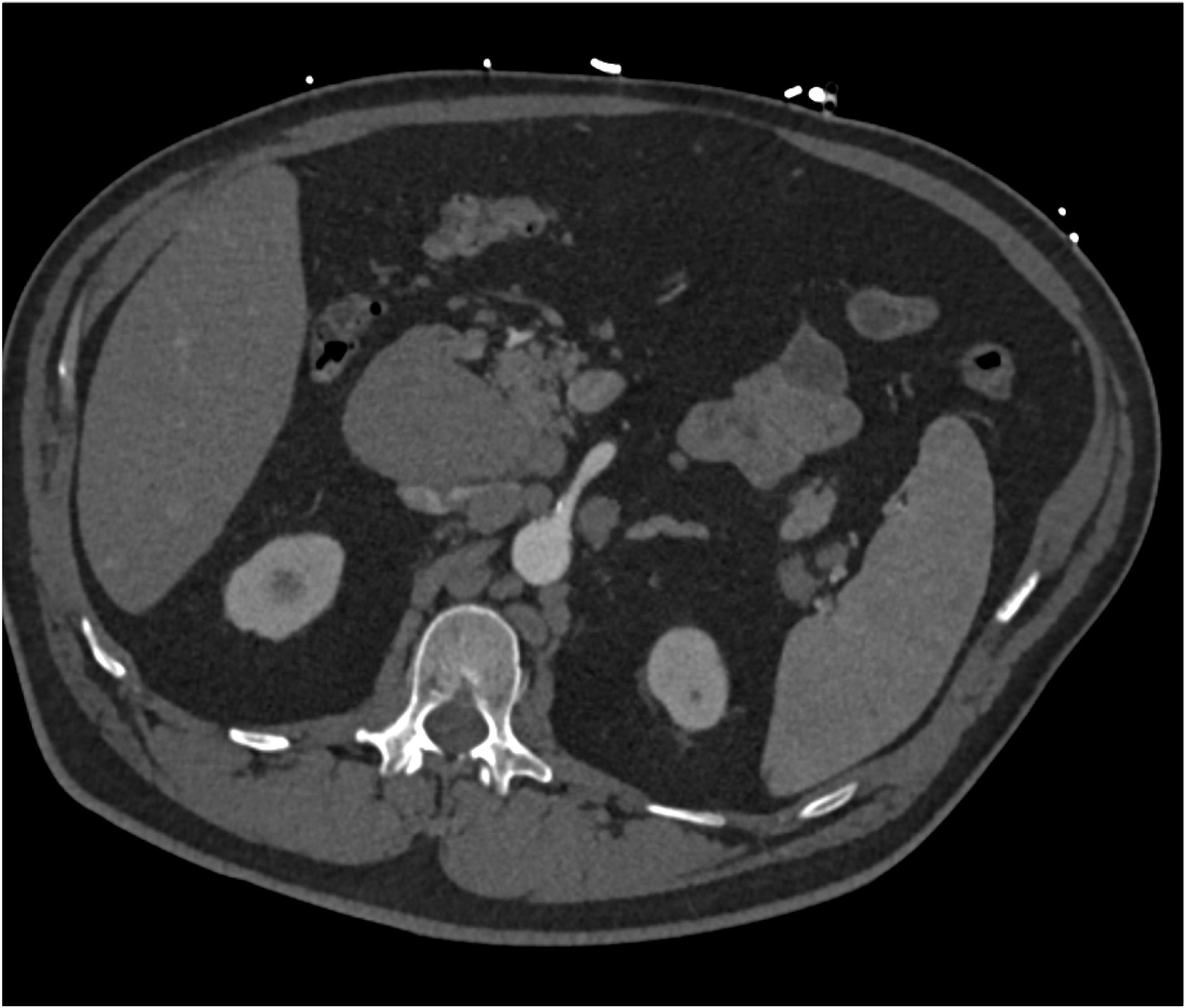 CTisus Quiz