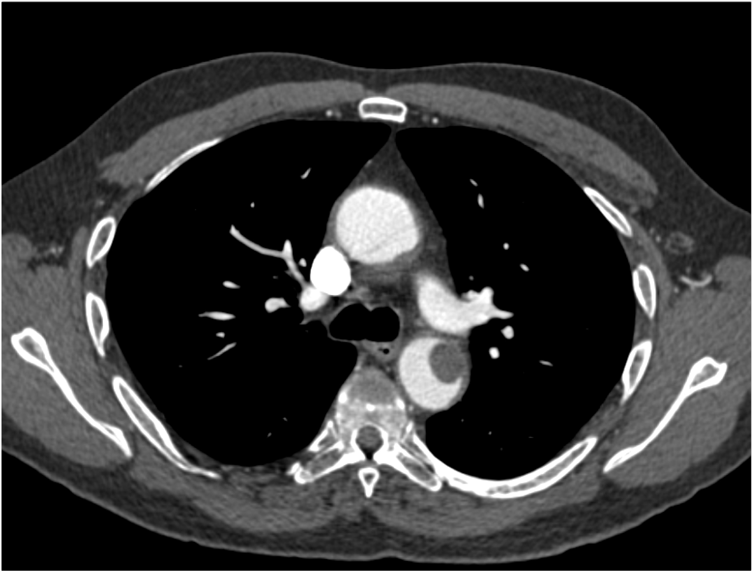 CTisus Quiz