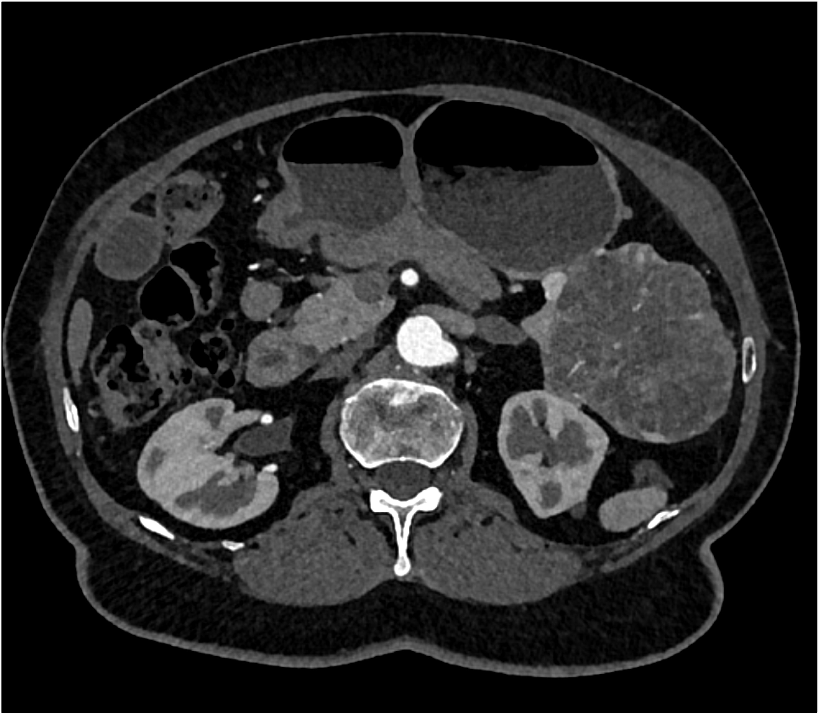 CTisus Quiz