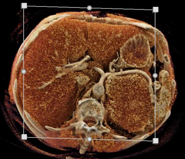 CTisus Case Studies