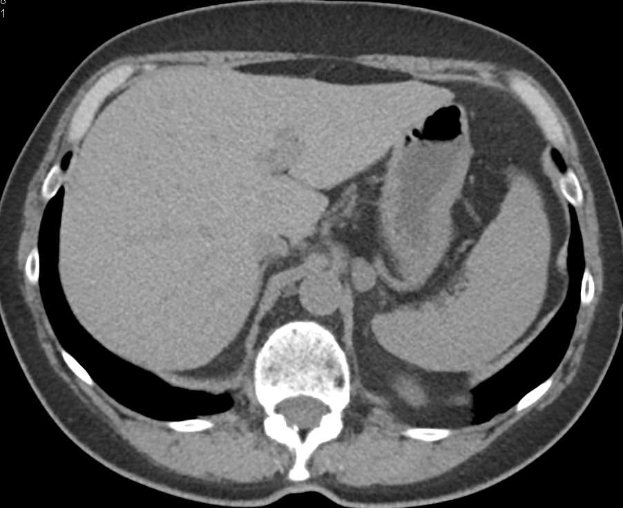 CTisus Case Studies