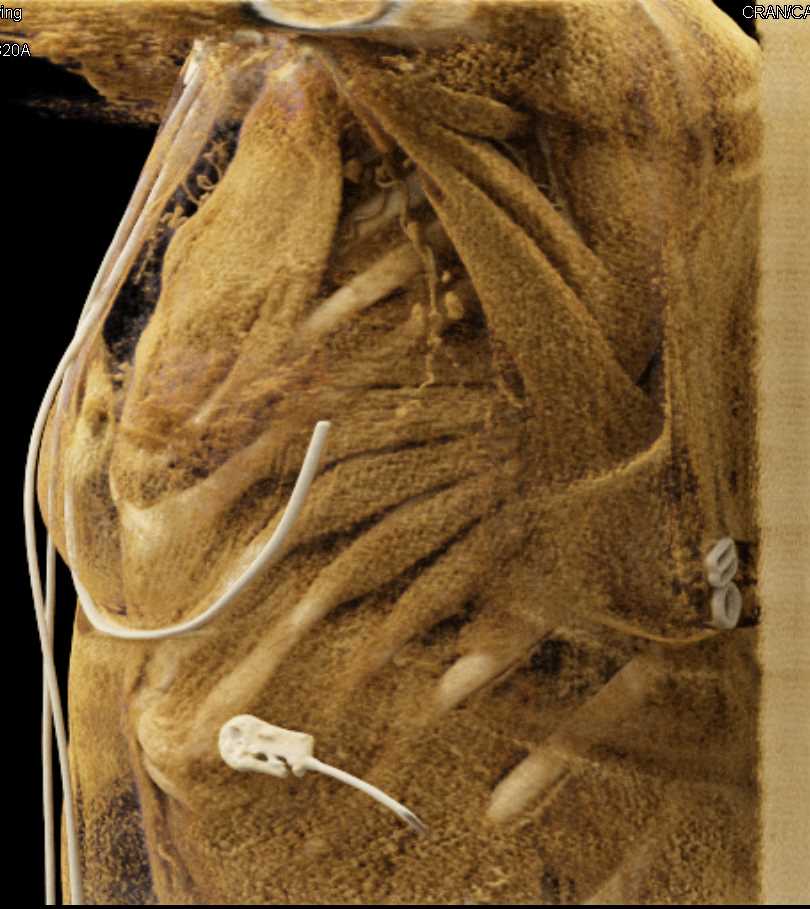 CTisus Case Studies