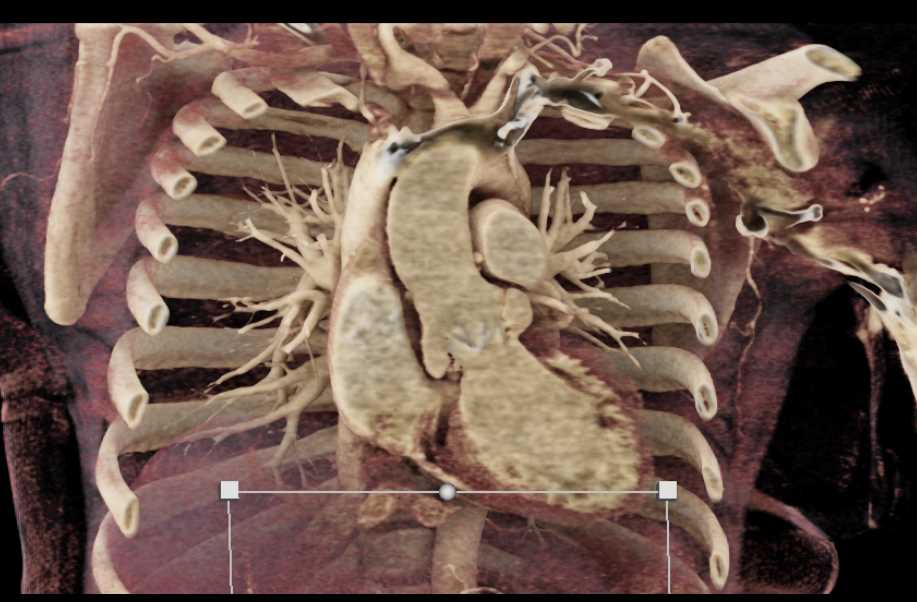 CTisus Case Studies