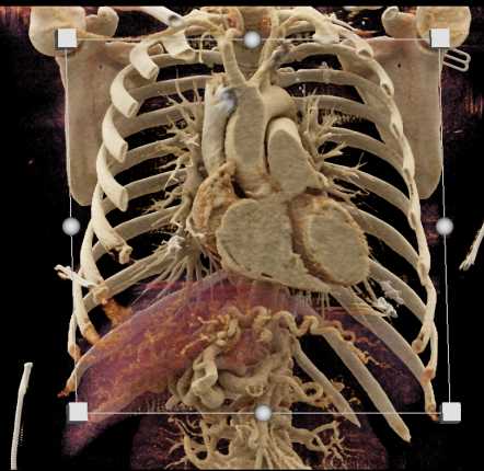 CTisus Case Studies
