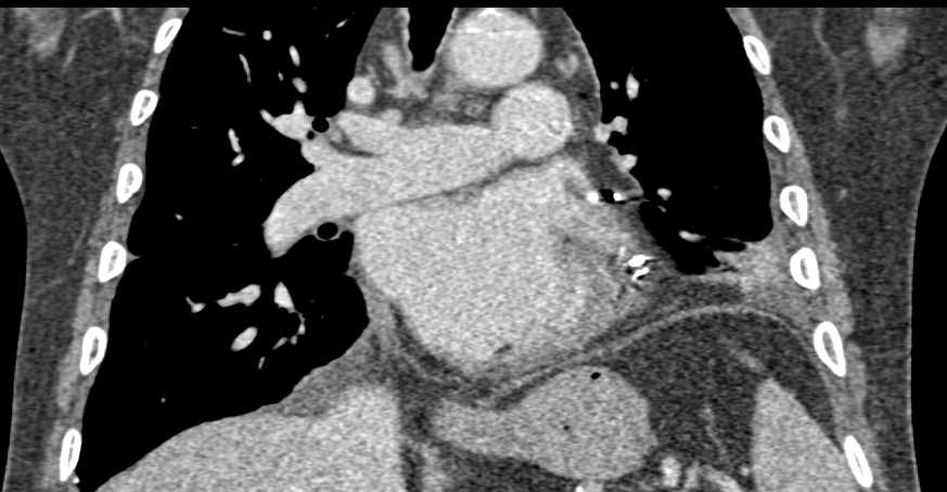 CTisus Case Studies