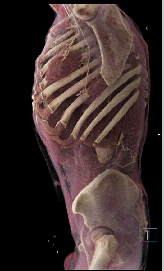 CTisus Case Studies