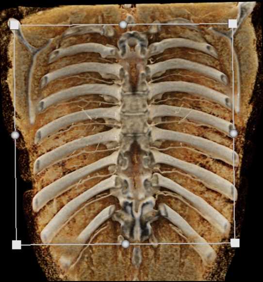 CTisus Case Studies