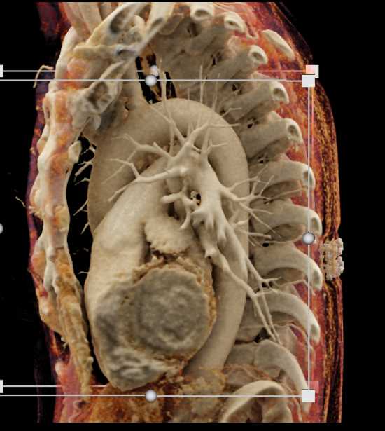 CTisus Case Studies