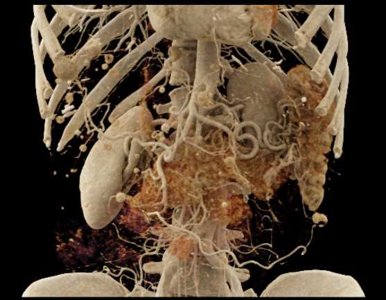 CTisus Case Studies