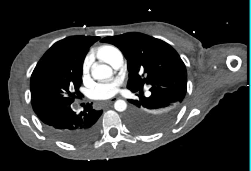 CTisus Case Studies