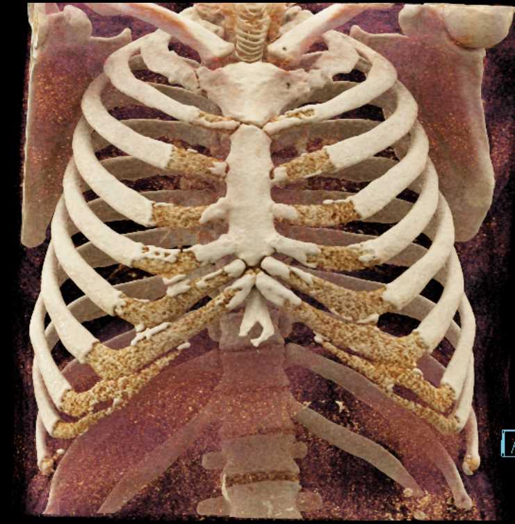CTisus Case Studies