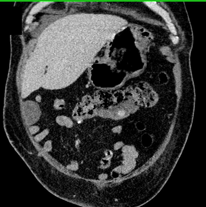 CTisus Case Studies