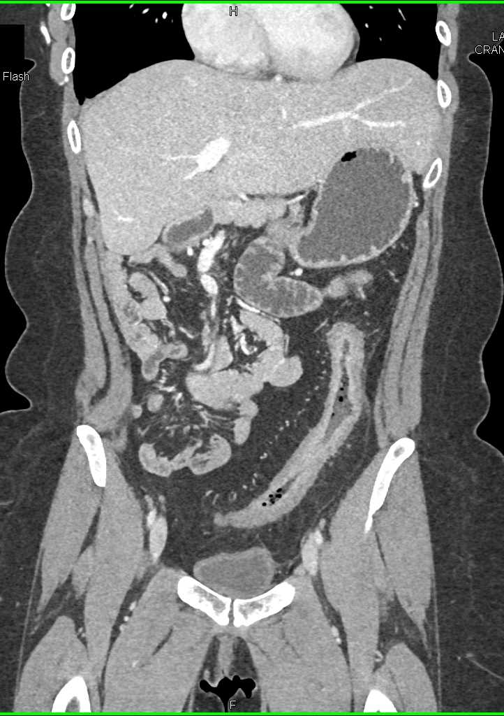 CTisus Case Studies