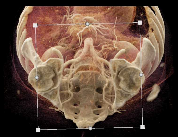 CTisus Case Studies