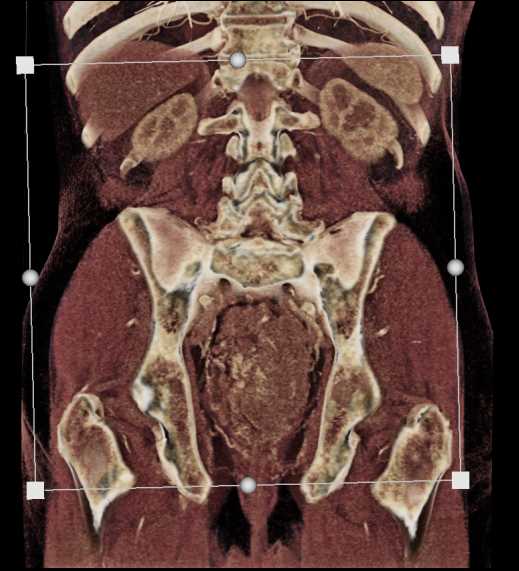 CTisus Case Studies