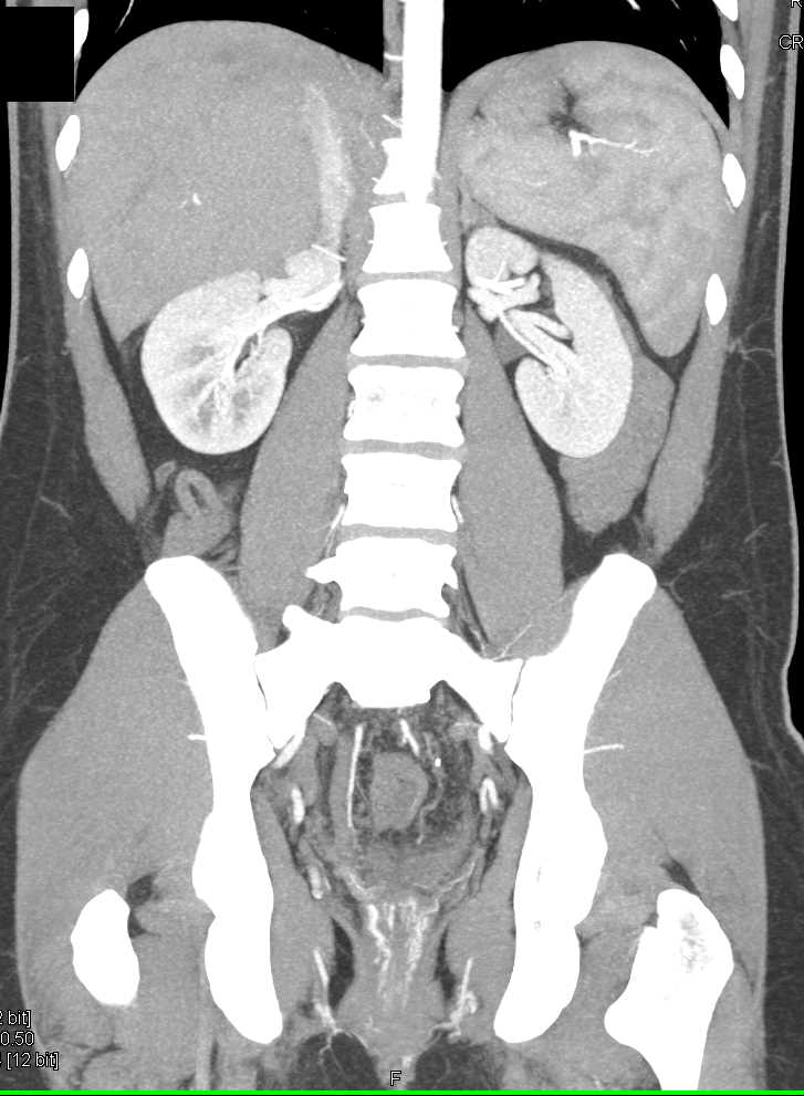 CTisus Case Studies