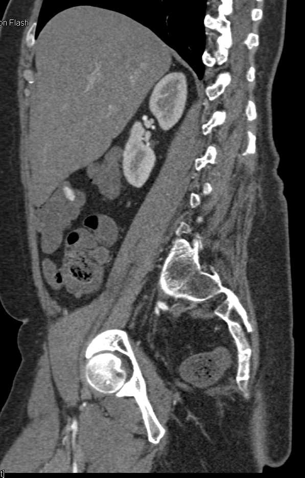 CTisus Case Studies