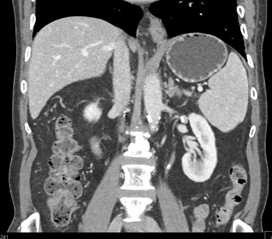CTisus Case Studies
