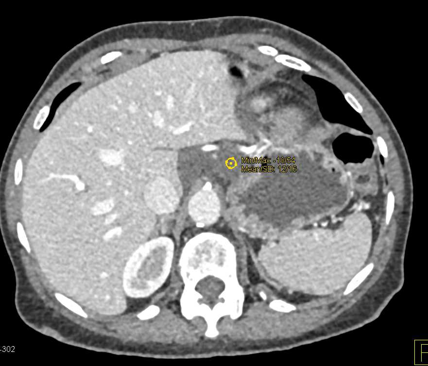 CTisus | Everything you need to know about Computed Tomography (CT ...