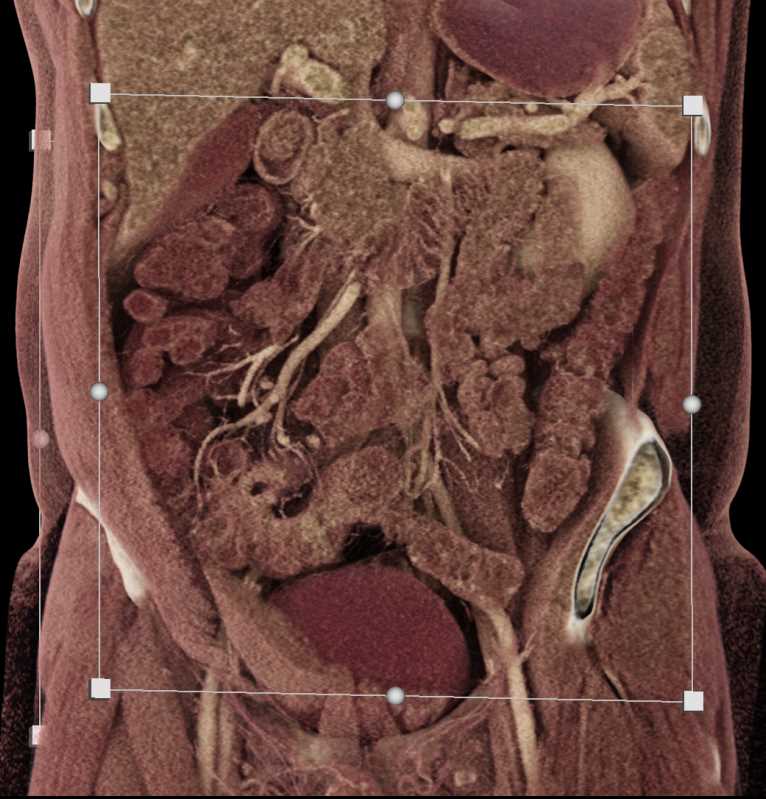 CTisus Case Studies