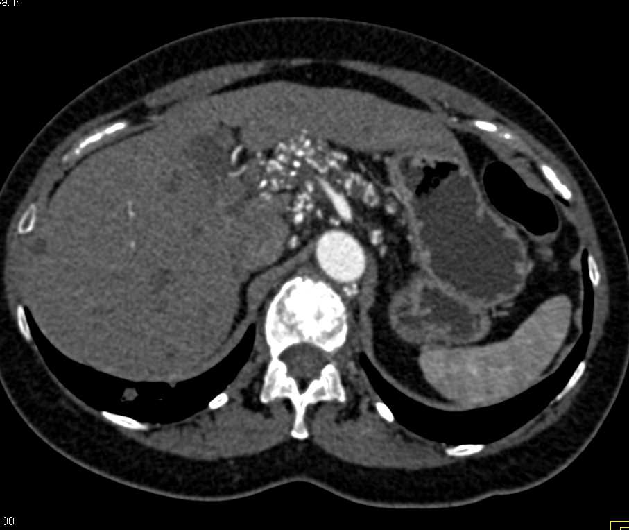 CTisus Case Studies