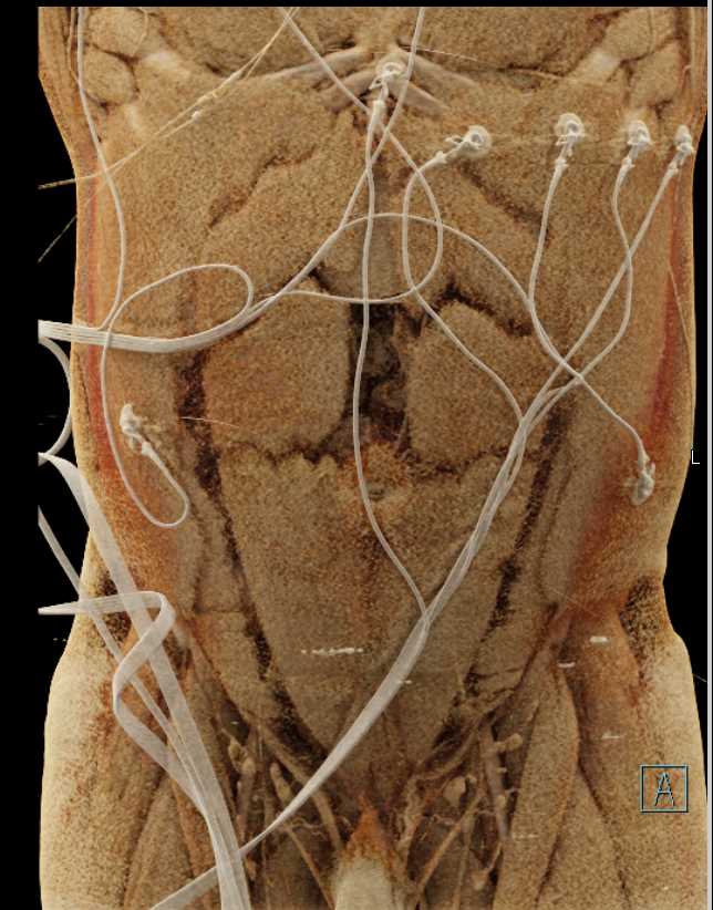 CTisus Case Studies