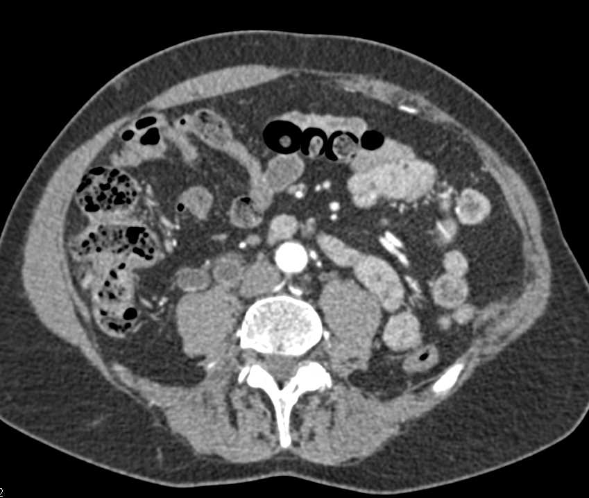 CTisus Case Studies