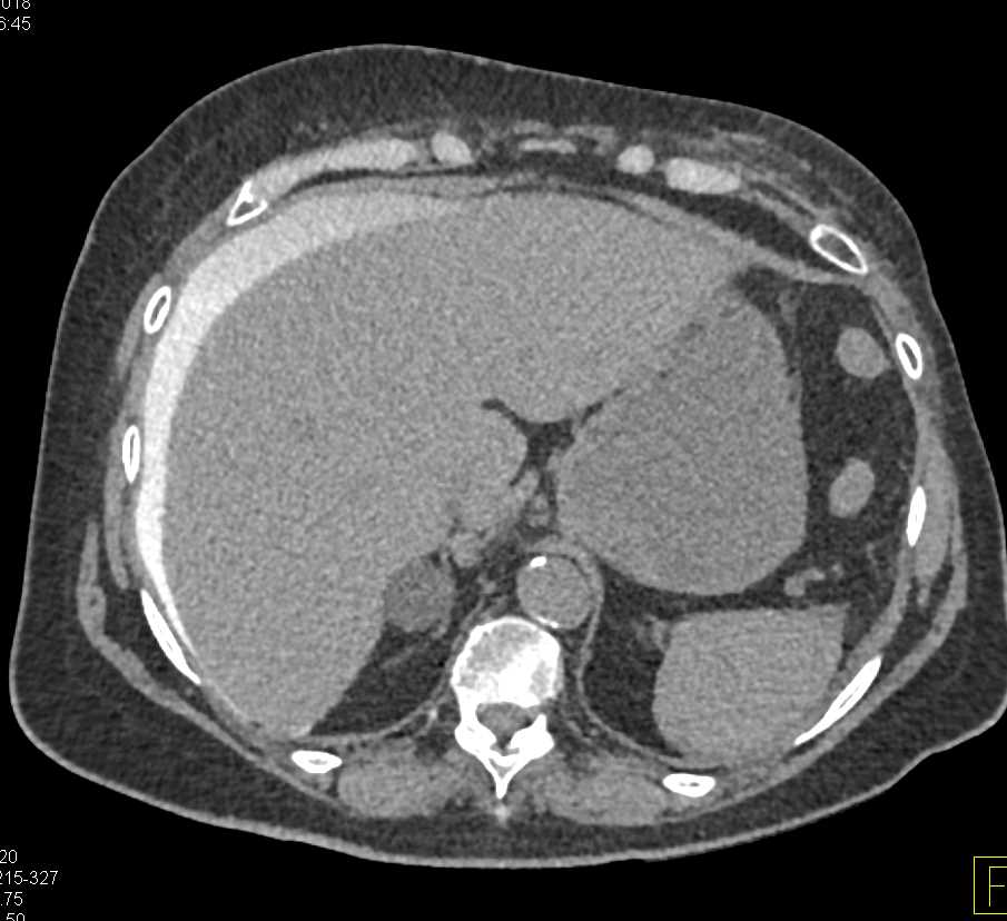 CTisus Case Studies