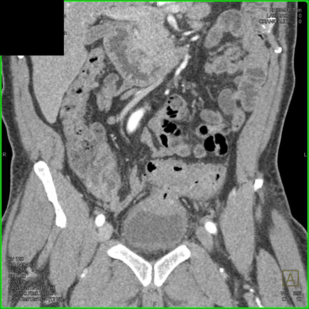 CTisus Case Studies