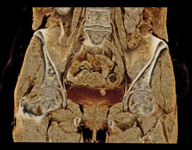 CTisus Case Studies