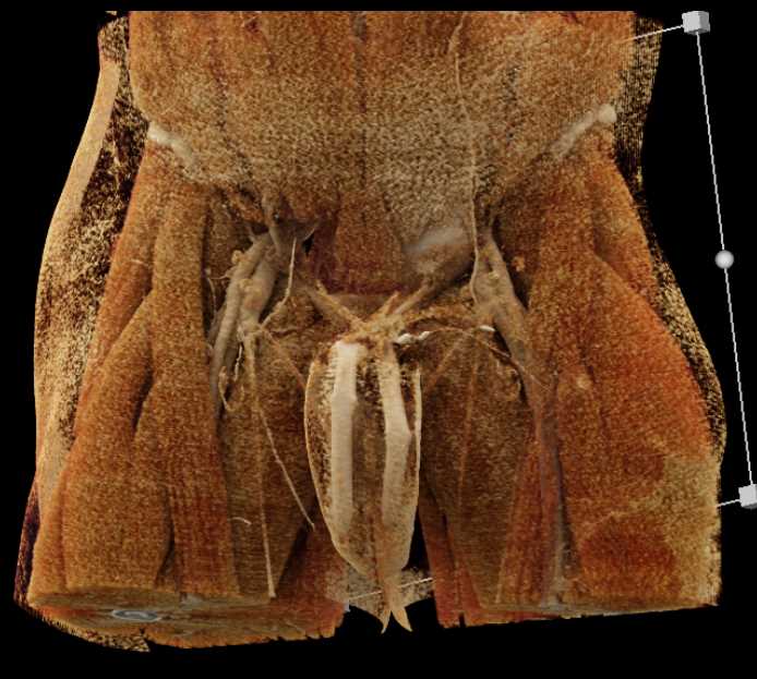 CTisus Case Studies
