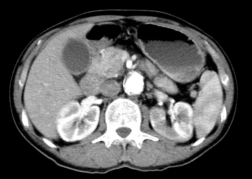 CTisus Case Studies