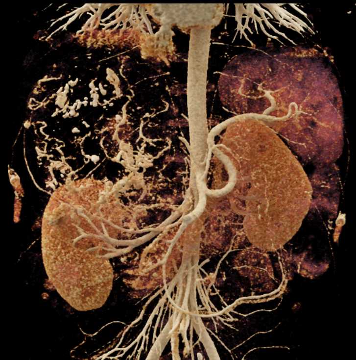 CTisus Case Studies