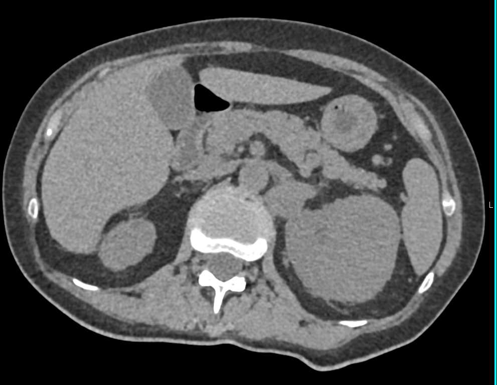 CTisus Case Studies
