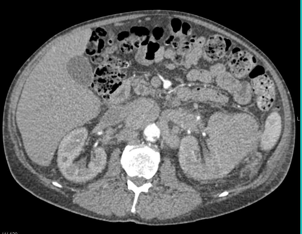 CTisus Case Studies