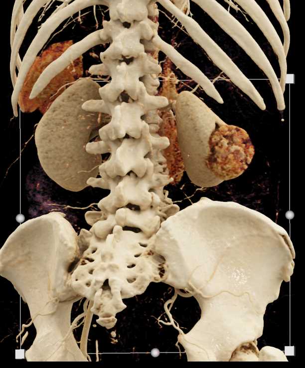 CTisus Case Studies