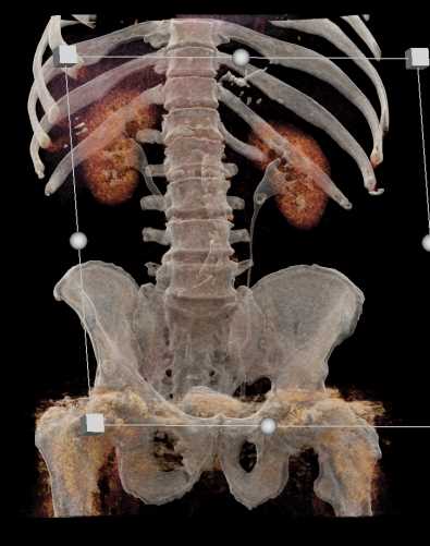 CTisus Case Studies