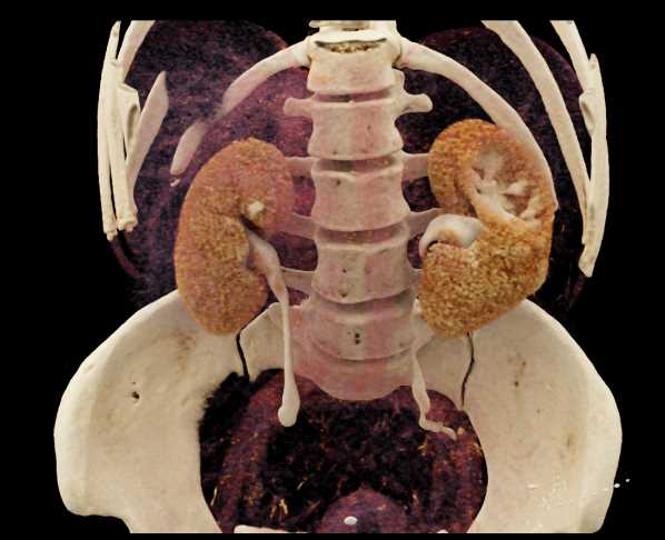 CTisus Case Studies