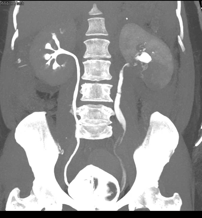CTisus Case Studies