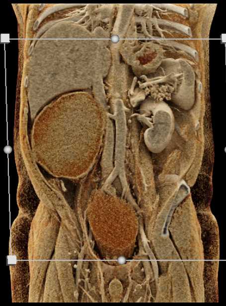 CTisus Case Studies