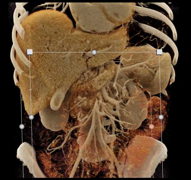 CTisus Case Studies