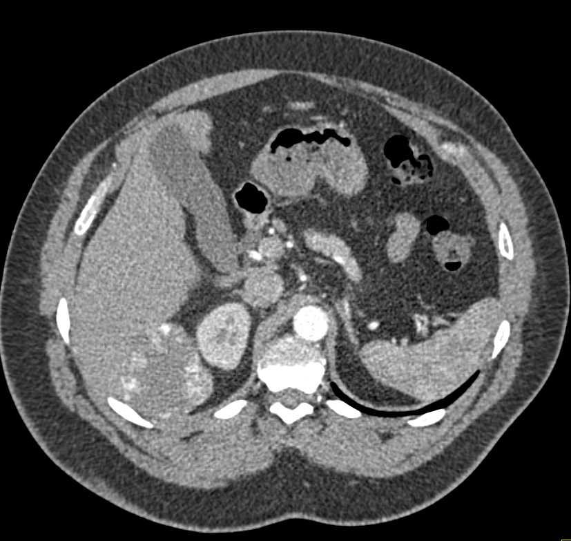 CTisus Case Studies